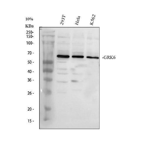 Anti-GRK6 Antibody Picoband® Boster Bio