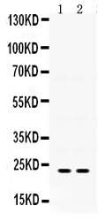 Anti-IGFBP5 Antibody Picoband® Boster Bio