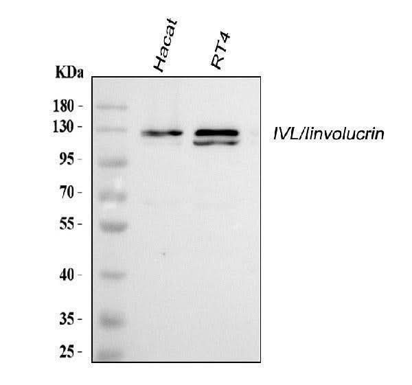 Anti-Involucrin/IVL Antibody Picoband® Boster Bio