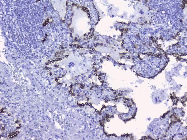 Anti-Cytokeratin 19/KRT19 Antibody Picoband® Boster Bio
