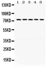 Anti-LIMK1 Antibody Picoband® Boster Bio