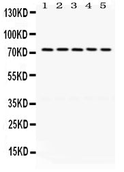 Anti-LIMK1 Antibody Picoband® Boster Bio