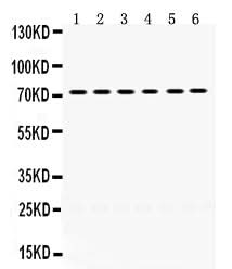 Anti-LIM kinase 2/LIMK2 Antibody Picoband® Boster Bio