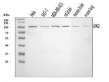Anti-LOXL2 Antibody Picoband® Boster Bio