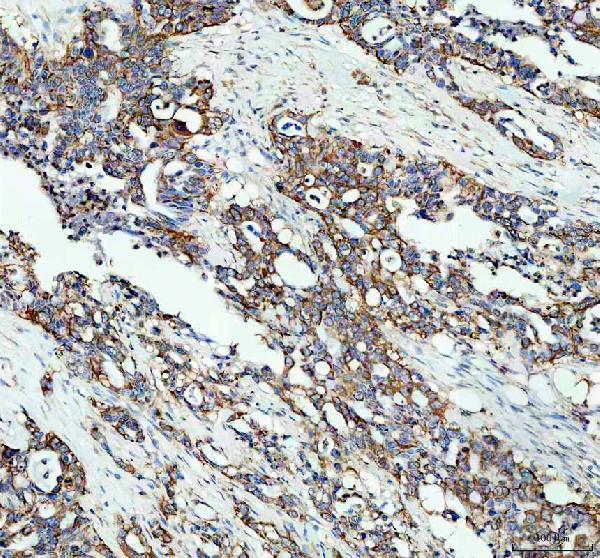 Anti-Microsomal Glutathione S-transferase 1/MGST1 Antibody Picoband® Boster Bio