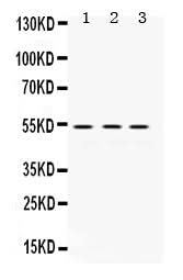 Anti-MMP1 Antibody Picoband® Boster Bio