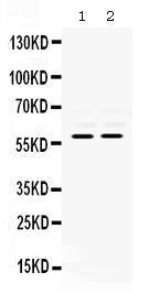 Anti-MMP8 Antibody Picoband® Boster Bio