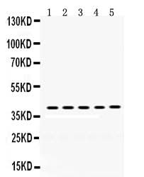 Anti-Oncostatin M/OSM Antibody Picoband® Boster Bio
