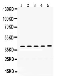 Anti-Oncostatin M/OSM Antibody Picoband® Boster Bio