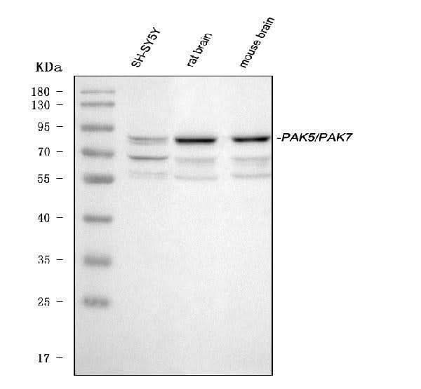 Anti-PAK5/PAK7 Antibody Picoband® Boster Bio