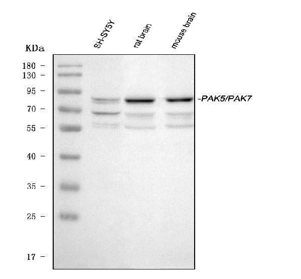 Anti-PAK5/PAK7 Antibody Picoband® Boster Bio