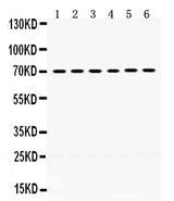 Anti-PDPK1 Antibody Picoband® Boster Bio
