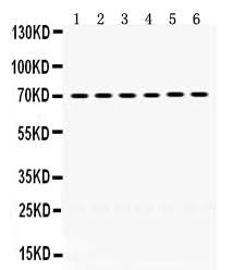 Anti-PDPK1 Antibody Picoband® Boster Bio