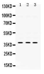 Anti-AMPK beta 1/PRKAB1 Antibody Picoband® Boster Bio