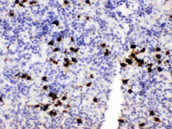 Anti-MRP8/S100A8 Antibody Picoband® Boster Bio