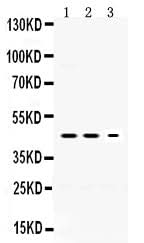 Anti-Neuroserpin/SERPINI1 Antibody Picoband® Boster Bio
