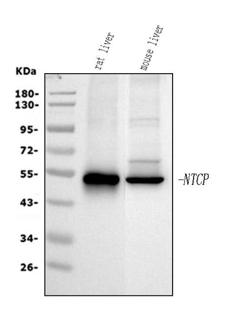 Anti-SLC10A1 Antibody Picoband® Boster Bio