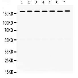 Anti-SMC3 Antibody Picoband® Boster Bio