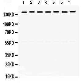 Anti-SMC3 Antibody Picoband® Boster Bio