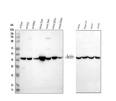 Anti-Actin/ACTA1 Antibody Picoband® Boster Bio