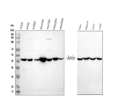 Anti-Actin/ACTA1 Antibody Picoband® Boster Bio
