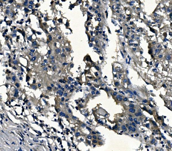 Anti-alpha 1d Adrenergic Receptor/ADRA1A Antibody Picoband® Boster Bio