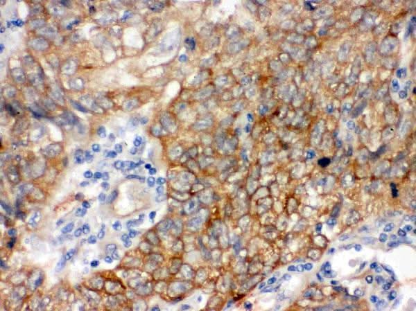 Anti-Bag3 Antibody Picoband® Boster Bio