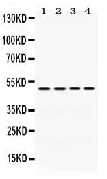Anti-DDB2 Antibody Picoband® Boster Bio