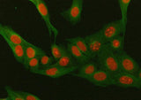 Anti-Mineralocorticoid Receptor/NR3C2 Antibody Picoband® Boster Bio