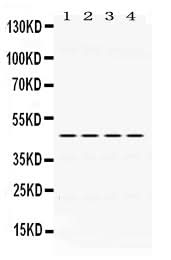 Anti-PAX6 Antibody Picoband® Boster Bio