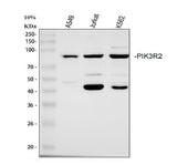Anti-PI 3 Kinase p85 beta/PIK3R2 Antibody Picoband® Boster Bio