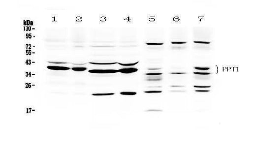 Anti-PPT1 Antibody Picoband® Boster Bio
