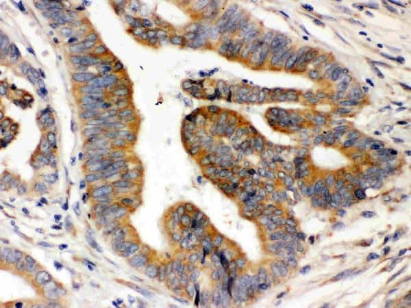 Anti-Rab5/RAB5A Antibody Picoband® Boster Bio