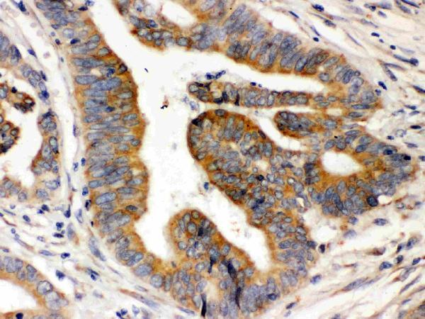 Anti-Rab5/RAB5A Antibody Picoband® Boster Bio