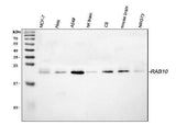 Anti-RAB10 Antibody Picoband® Boster Bio