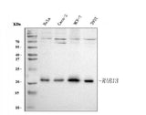 Anti-RAB13 Antibody Picoband® Boster Bio