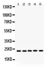 Anti-Rab18 Antibody Picoband® Boster Bio