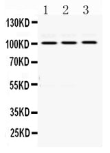 Anti-RASA1 Antibody Picoband® Boster Bio