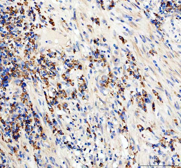 Anti-CD19 Antibody Picoband® Boster Bio