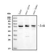 Anti-Lck Antibody Picoband® Boster Bio