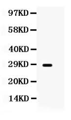 Anti-Aquaporin 0/MIP Antibody Picoband® Boster Bio