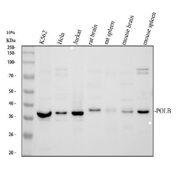 Anti-DNA Polymerase beta/POLB Antibody Picoband® Boster Bio