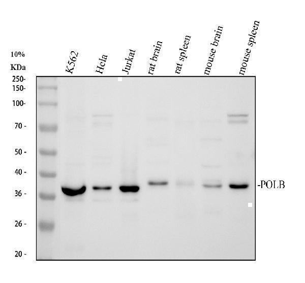 Anti-DNA Polymerase beta/POLB Antibody Picoband® Boster Bio