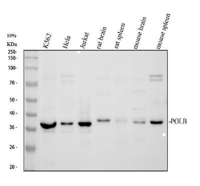 Anti-DNA Polymerase beta/POLB Antibody Picoband® Boster Bio