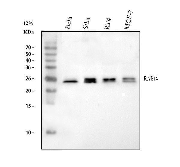 Anti-RAB14 Antibody Picoband® Boster Bio