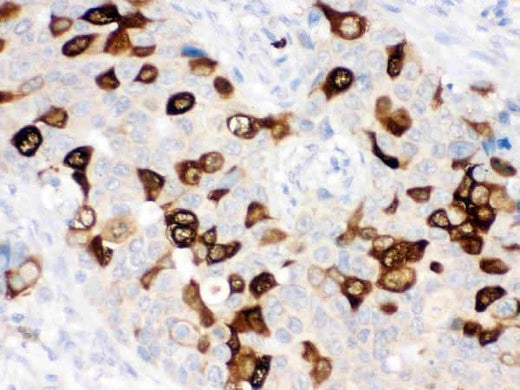 Anti-RRM2 Antibody Picoband® Boster Bio