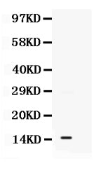 Anti-S100A11 Antibody Picoband® Boster Bio