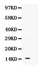 Anti-S100A11 Antibody Picoband® Boster Bio