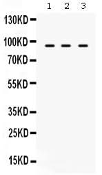 Anti-TAP1 Antibody Picoband® Boster Bio
