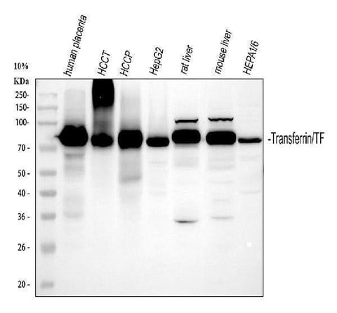 Anti-Transferrin/TF Antibody Picoband® Boster Bio